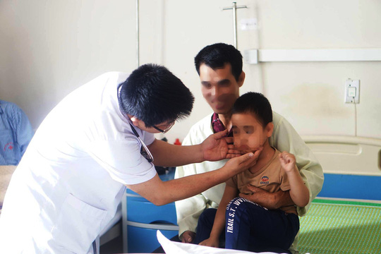 Bé trai 5 tuổi bỗng mọc lông rậm khắp mặt sau tiêm corticoid - Ảnh 1. Bé trai 5 tuổi bỗng mọc lông rậm khắp mặt sau tiêm corticoid - Ảnh 1.