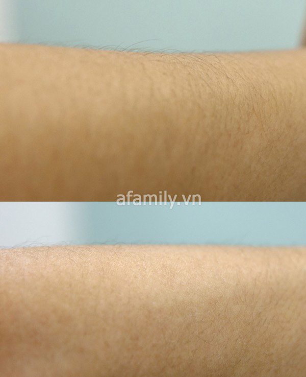 Bi hài máy nhổ lông nách nhưng sạch... lông chân 1 Bi hài máy nhổ lông nách nhưng sạch... lông chân 1