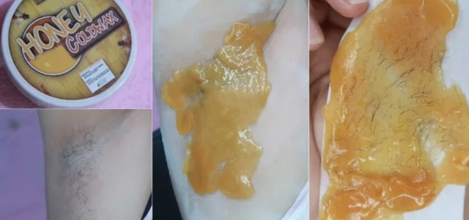 Phương pháp tẩy lông bằng sáp lạnh này sẽ giúp công cuộc waxing của bạn không trở thành mớ hỗn độn - Ảnh 8. Phương pháp tẩy lông bằng sáp lạnh này sẽ giúp công cuộc waxing của bạn không trở thành mớ hỗn độn - Ảnh 8.