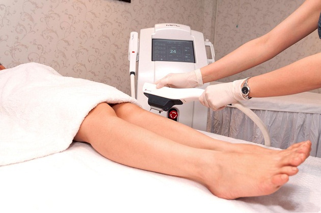 máy triệt lông - máy thẩm mỹ